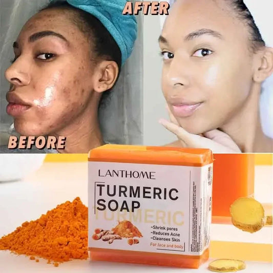 Glow & Clear Turmeric Soap