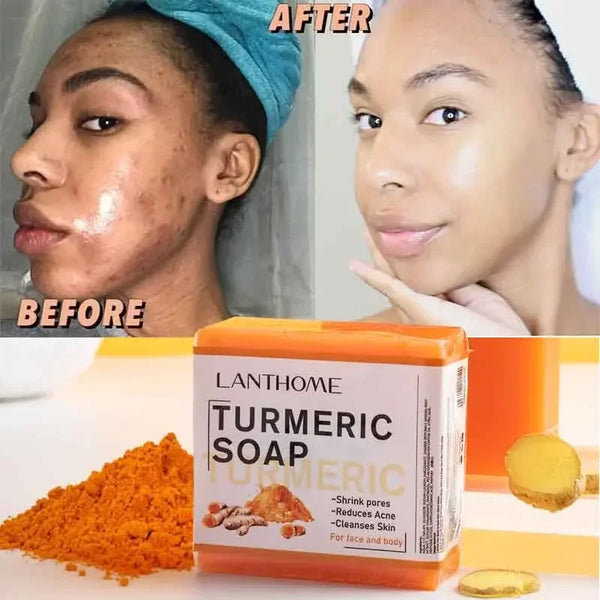 Glow & Clear Turmeric Soap